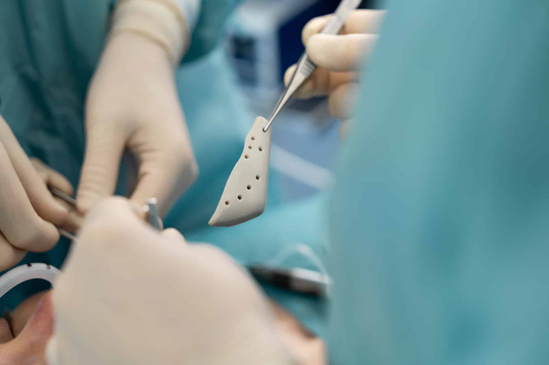 Alloplastic implant